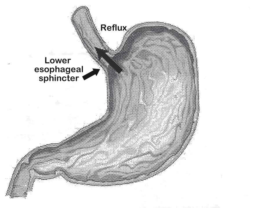 Esophagus